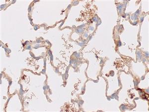 3746B | Control Slides:Immunopathology; Spirochete Treponema sp., Artificial